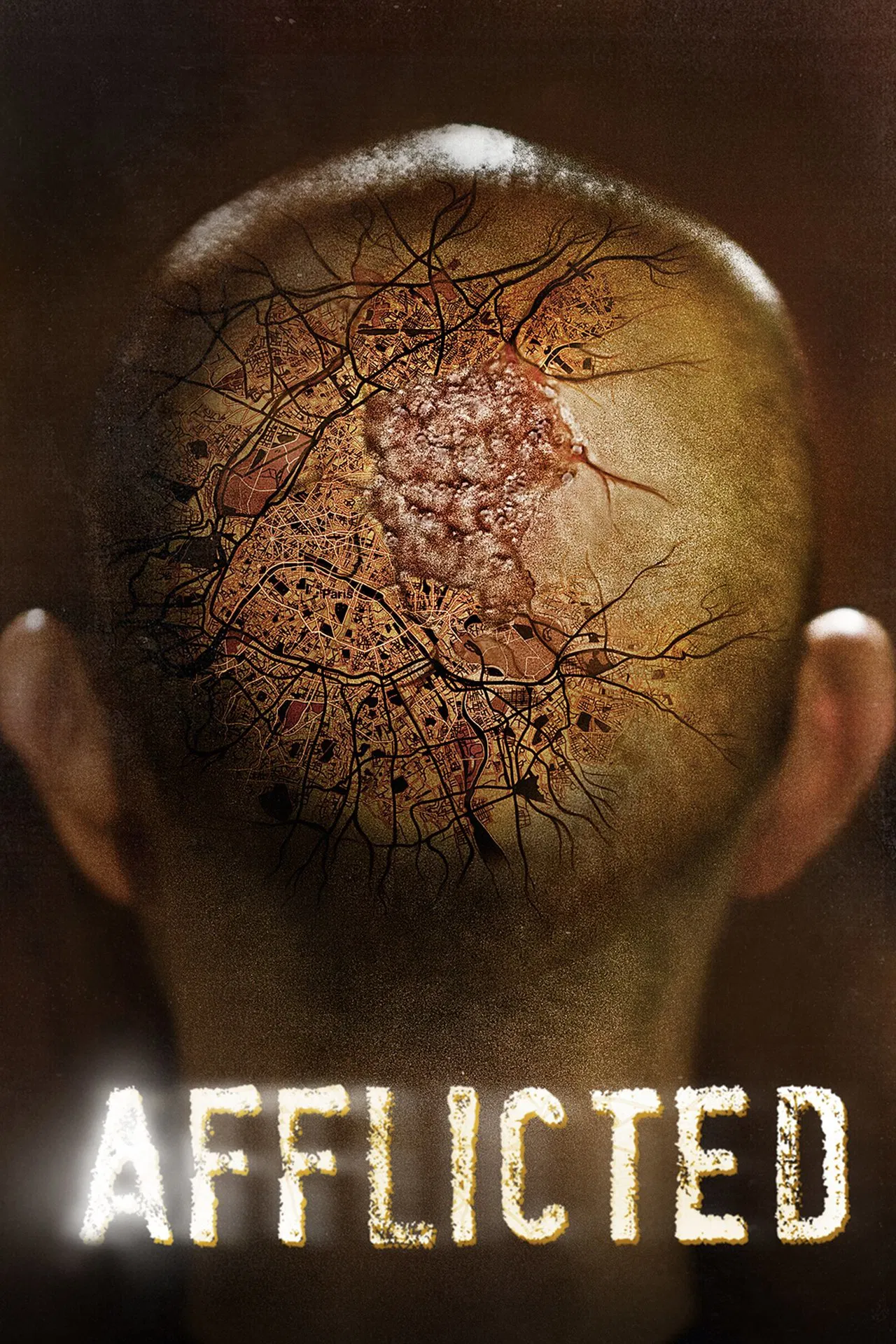 Afflicted (2013) มหาภัยเชื้อเหนือมนุษย์ พากย์ไทย
